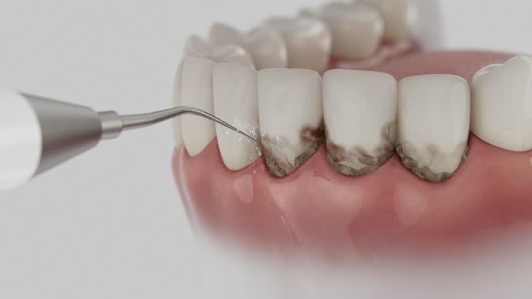 Trusted Teeth Cleaning And Checkup service in Jonestown, TX - Dentist Open Now
